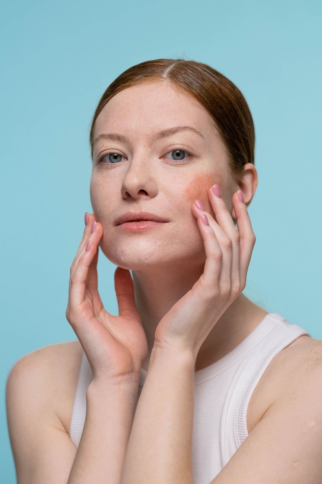 A calm, natural portrait reflecting soothed, redness-free skin.